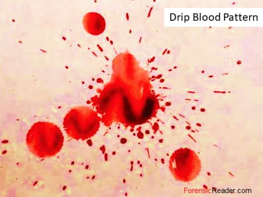 Drip Patterns of bloodstain