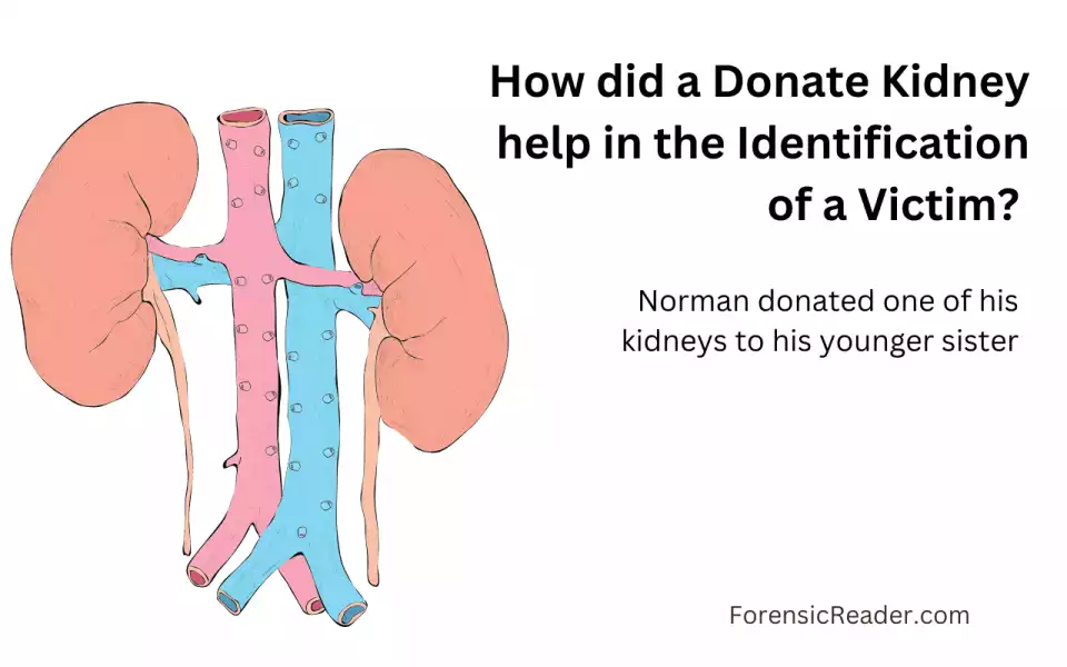 How did a Donate Kidney help in the Identification of Norman Klas or Norman Kloss