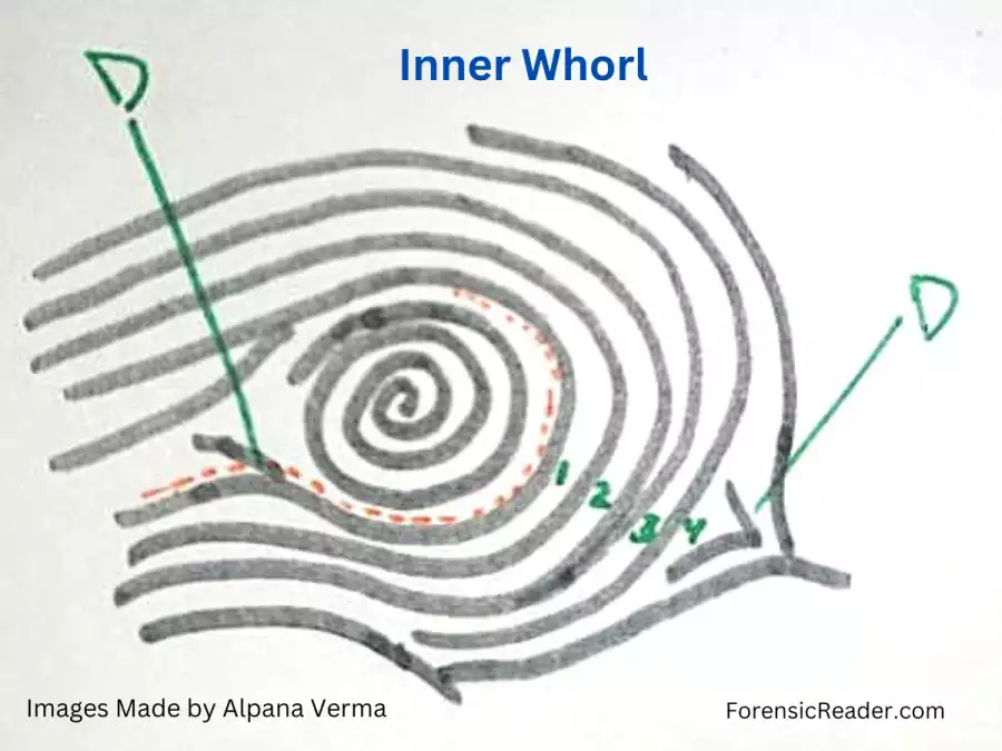 Inner Whorl in ridge tracing