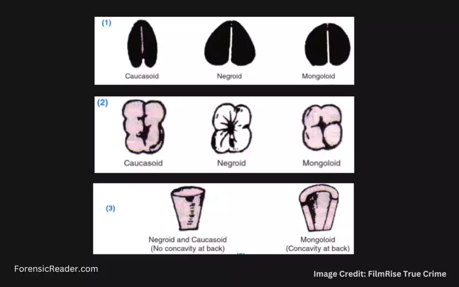 Here is the image representation of each of the teeth based on the above table.